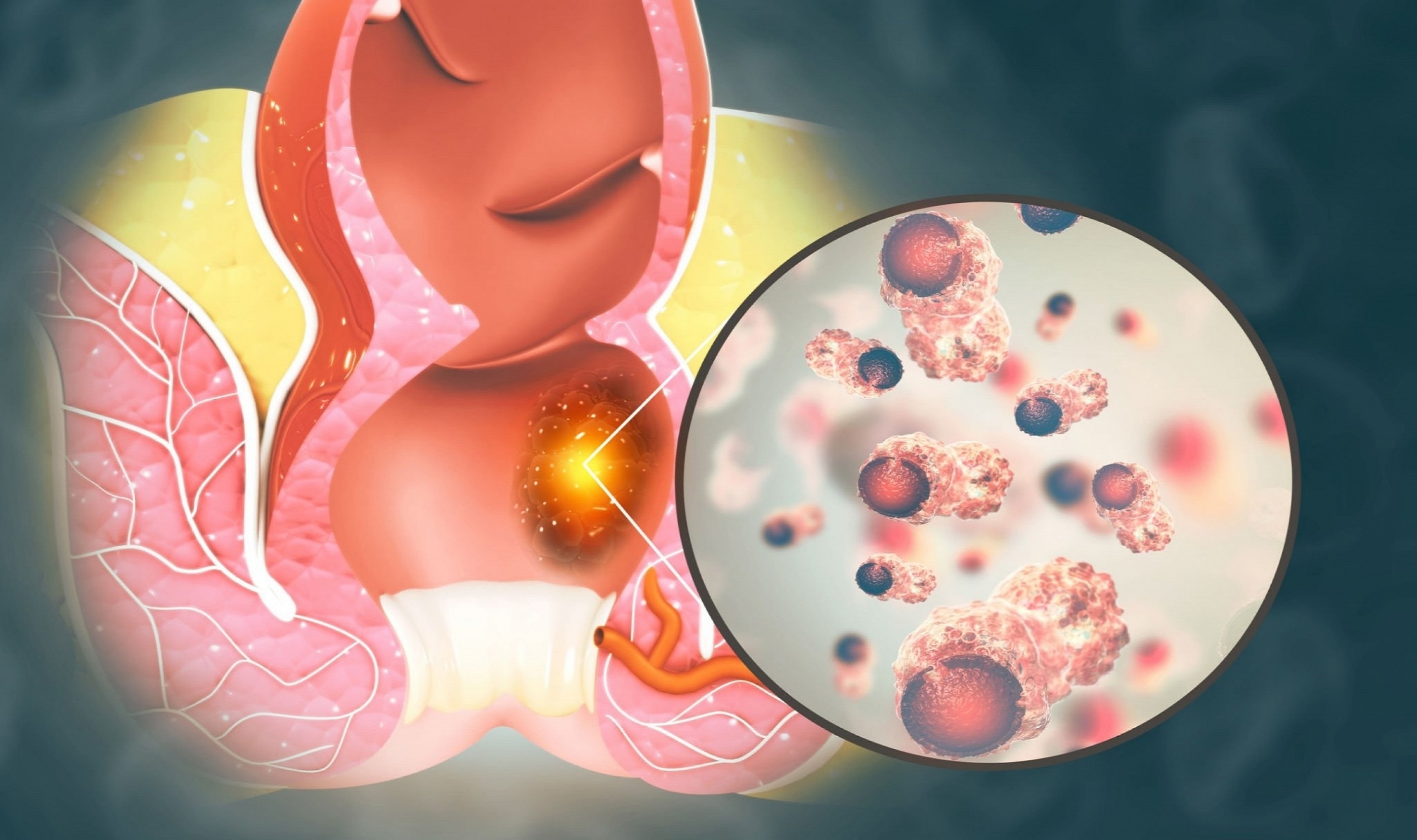 Advanced Ayurvedic Treatment for Piles and Anorectal Conditions