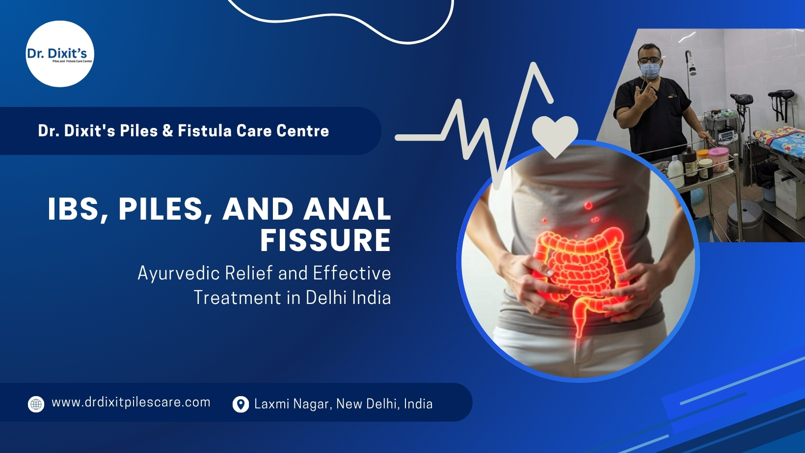 IBS, Piles, and Anal Fissure: Ayurvedic Relief and Effective Treatment in Delhi