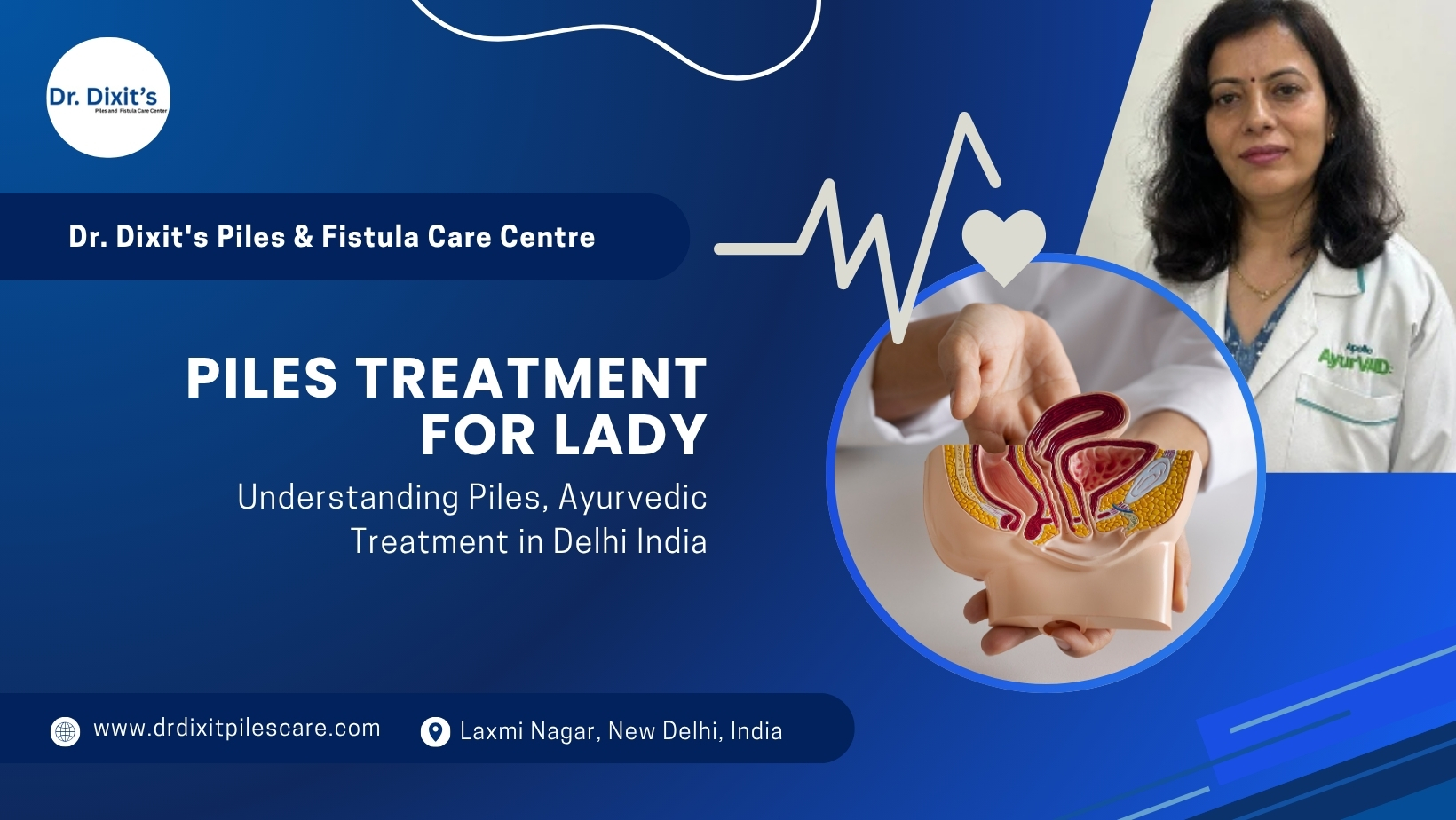 Safe Piles Treatment for lady in Laxmi Nagar, Delhi - Ayurvedic Options