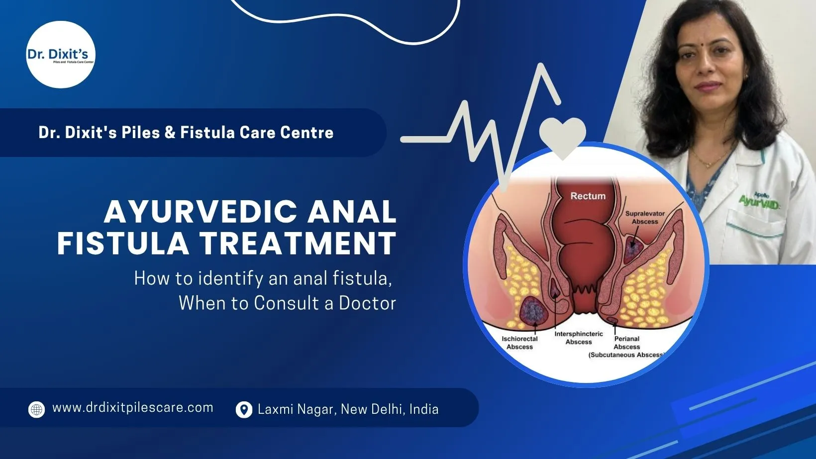 Ayurvedic Anal Fistula Treatment in Delhi from Dr. Dixit Piles Care