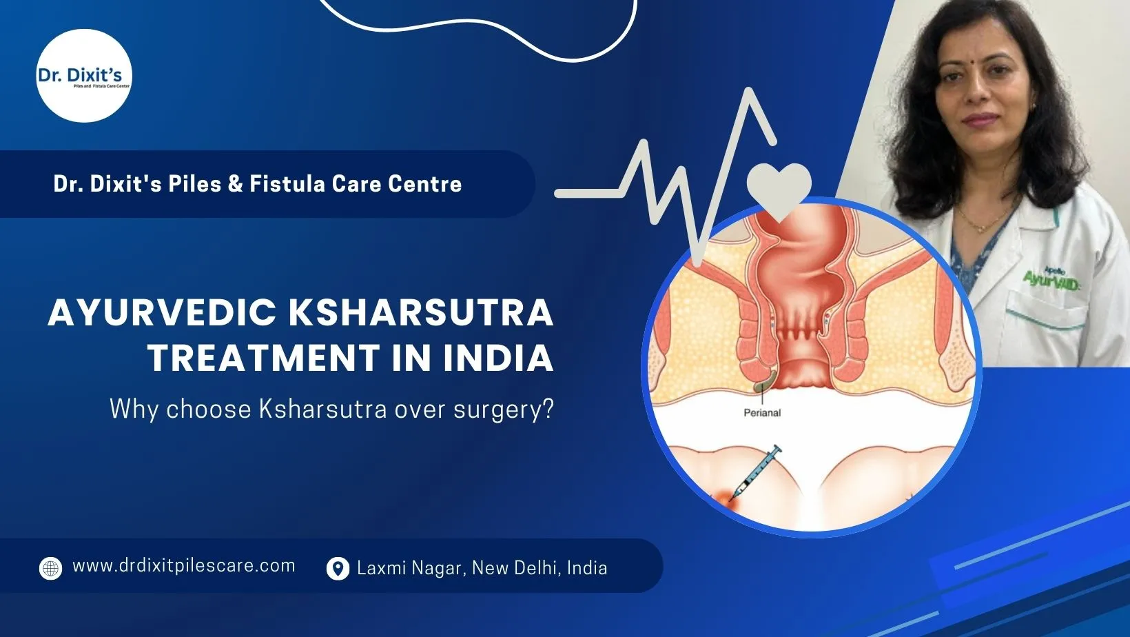Ayurvedic Ksharsutra Treatment in Delhi for Fistula Without Surgery