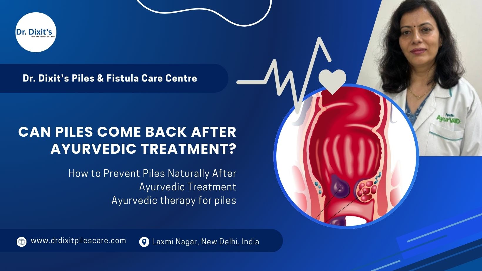 Can piles come back after Ayurvedic treatment? Here's What You Need to Know