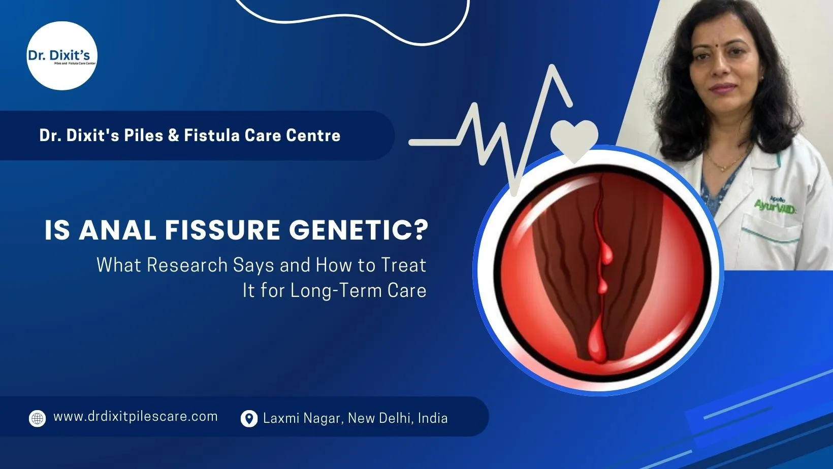 Is Anal Fissure Genetic? How To Treat It For Long-Term Care