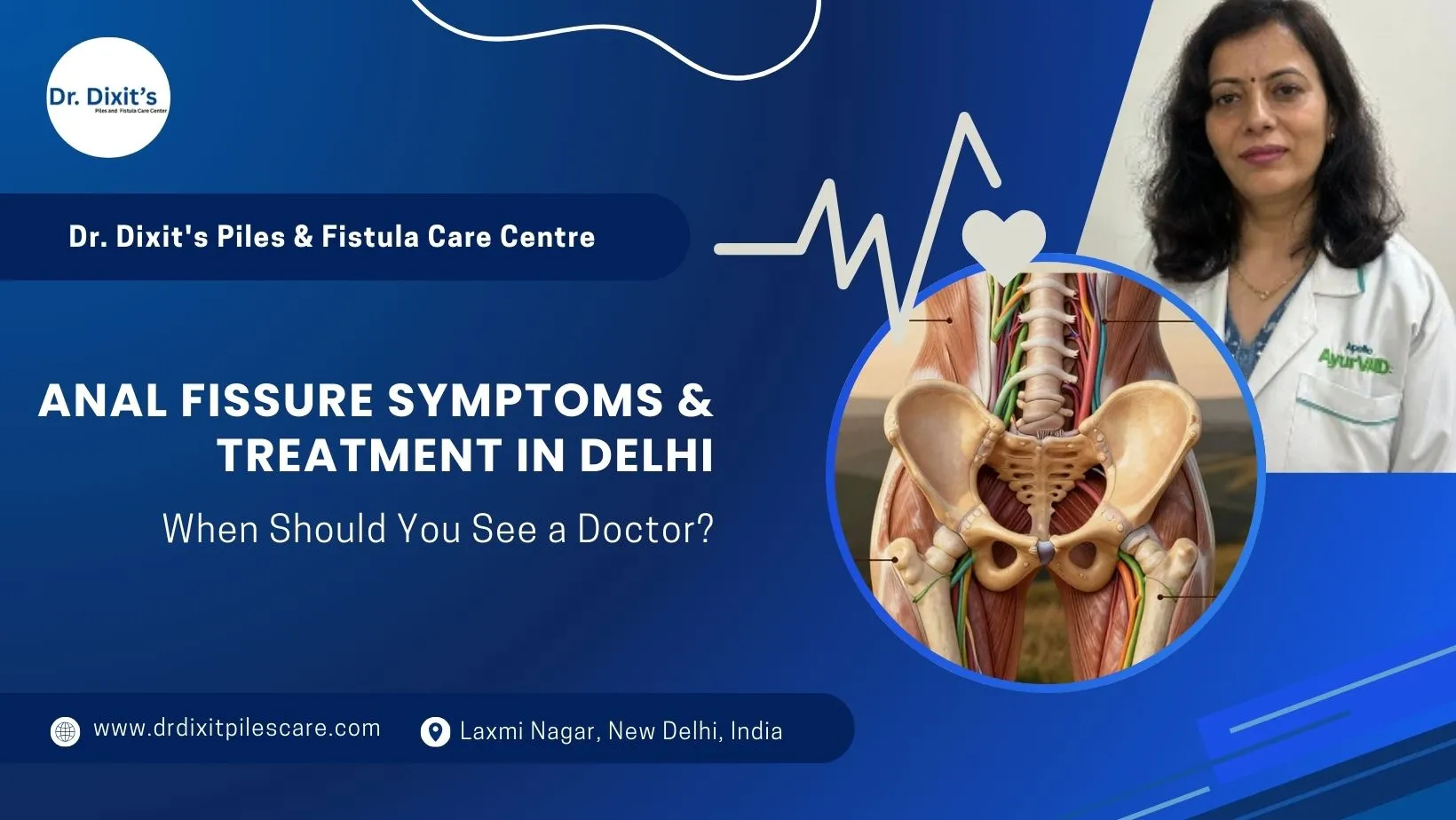 Anal Fissure Symptoms in Males & Females: Early Warning Signs