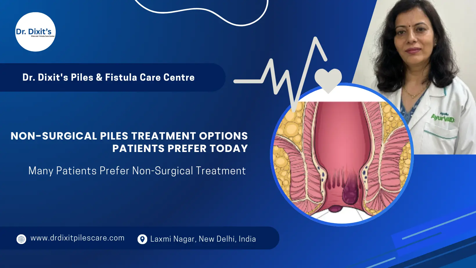 Best Non-Surgical Piles Treatment Options Patients Prefer Today in Delhi