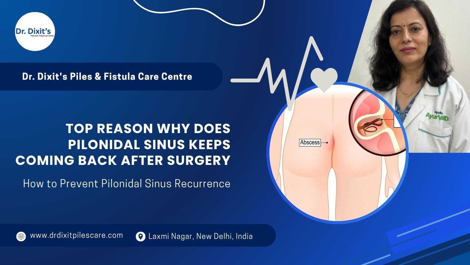 Top Reason Why does Pilonidal Sinus Keeps Coming Back after surgery