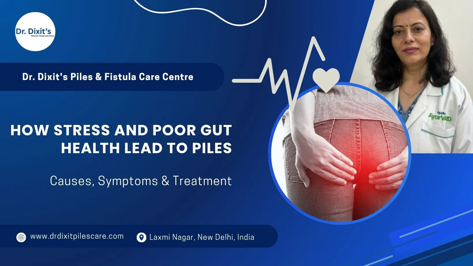 How Stress and Poor Gut Health Lead to Piles: Causes, Symptoms & Treatment