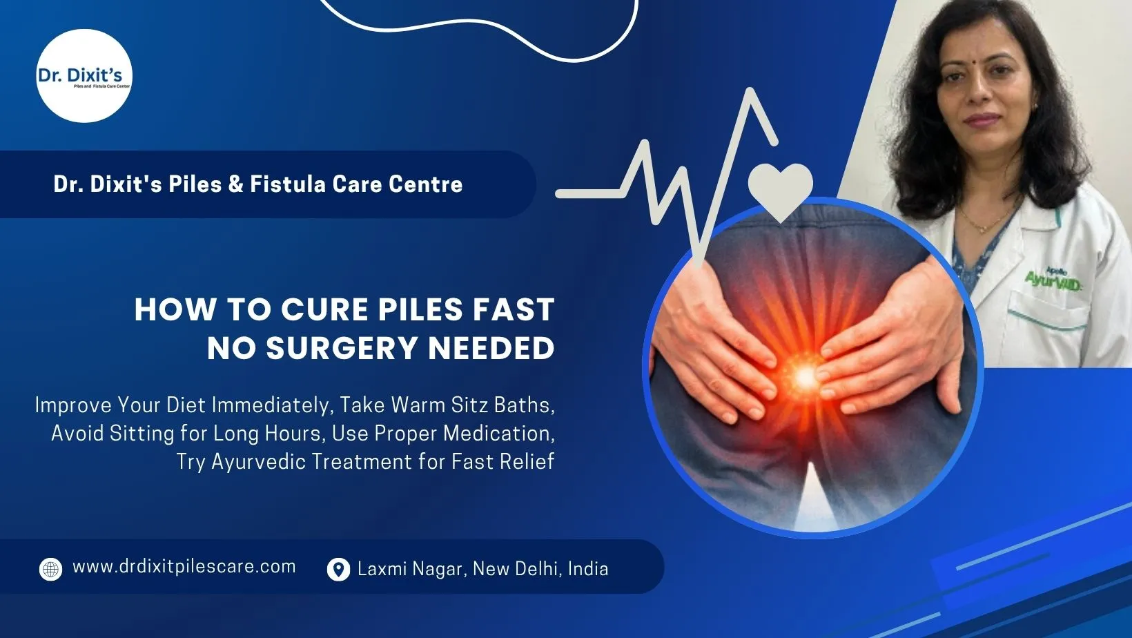 Fastest Way to Cure Piles Naturally and Permanently in Delhi