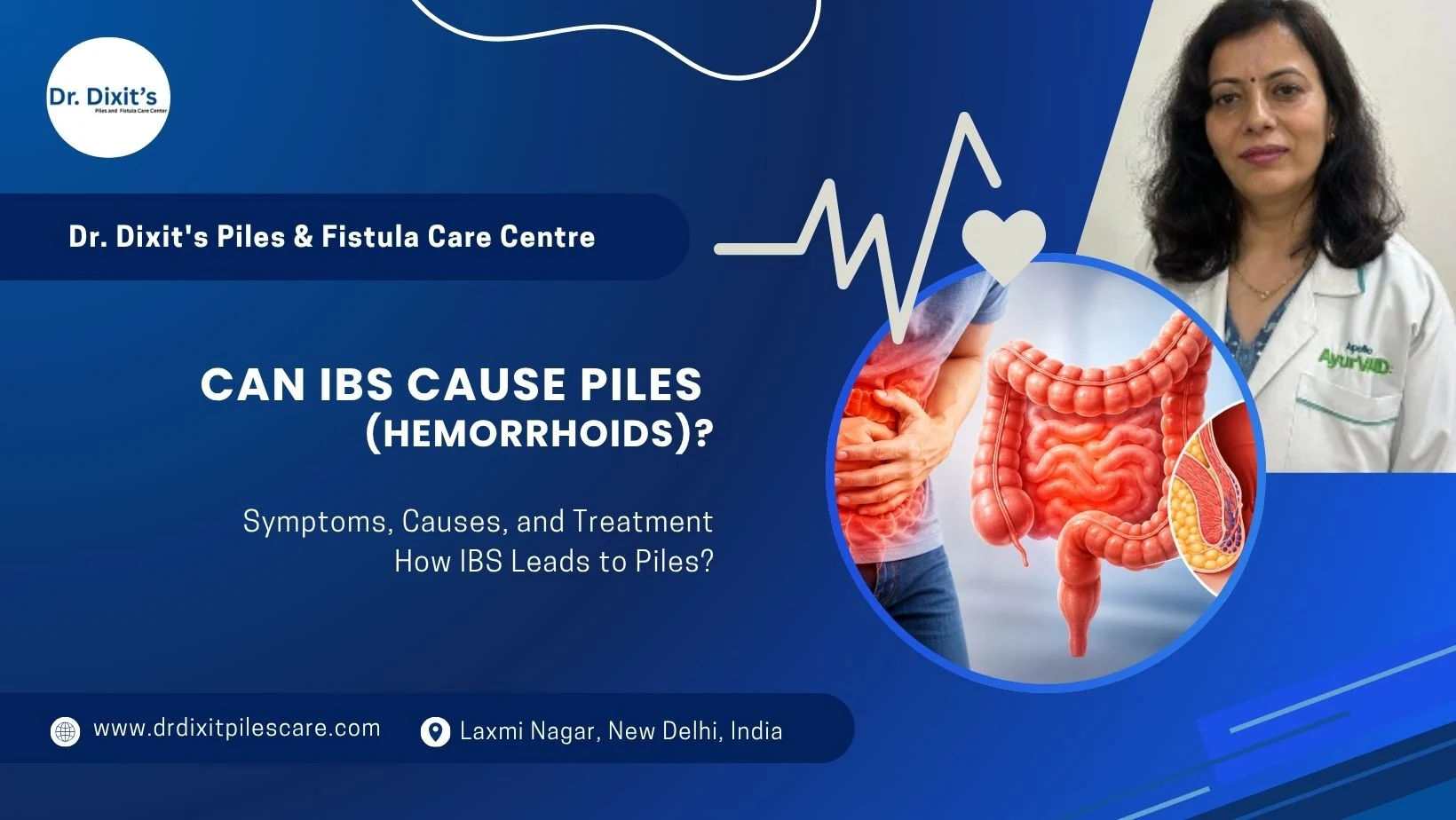 Can IBS Cause Piles (Hemorrhoids)? Symptoms, Causes, Treatment & Prevention