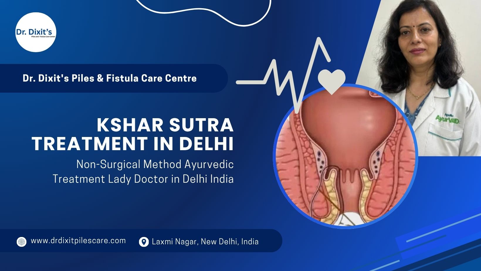 Kshar Sutra Treatment in Delhi - A Natural, Safe & Non-Surgical Method