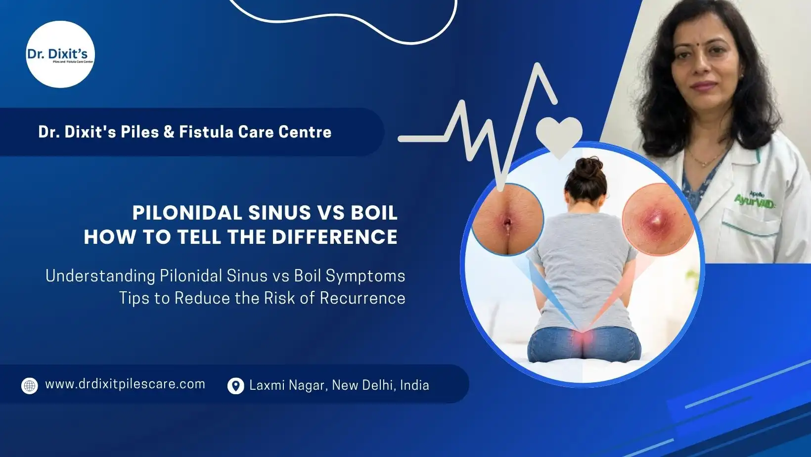 Pilonidal Sinus vs Boil: How to Tell the Difference