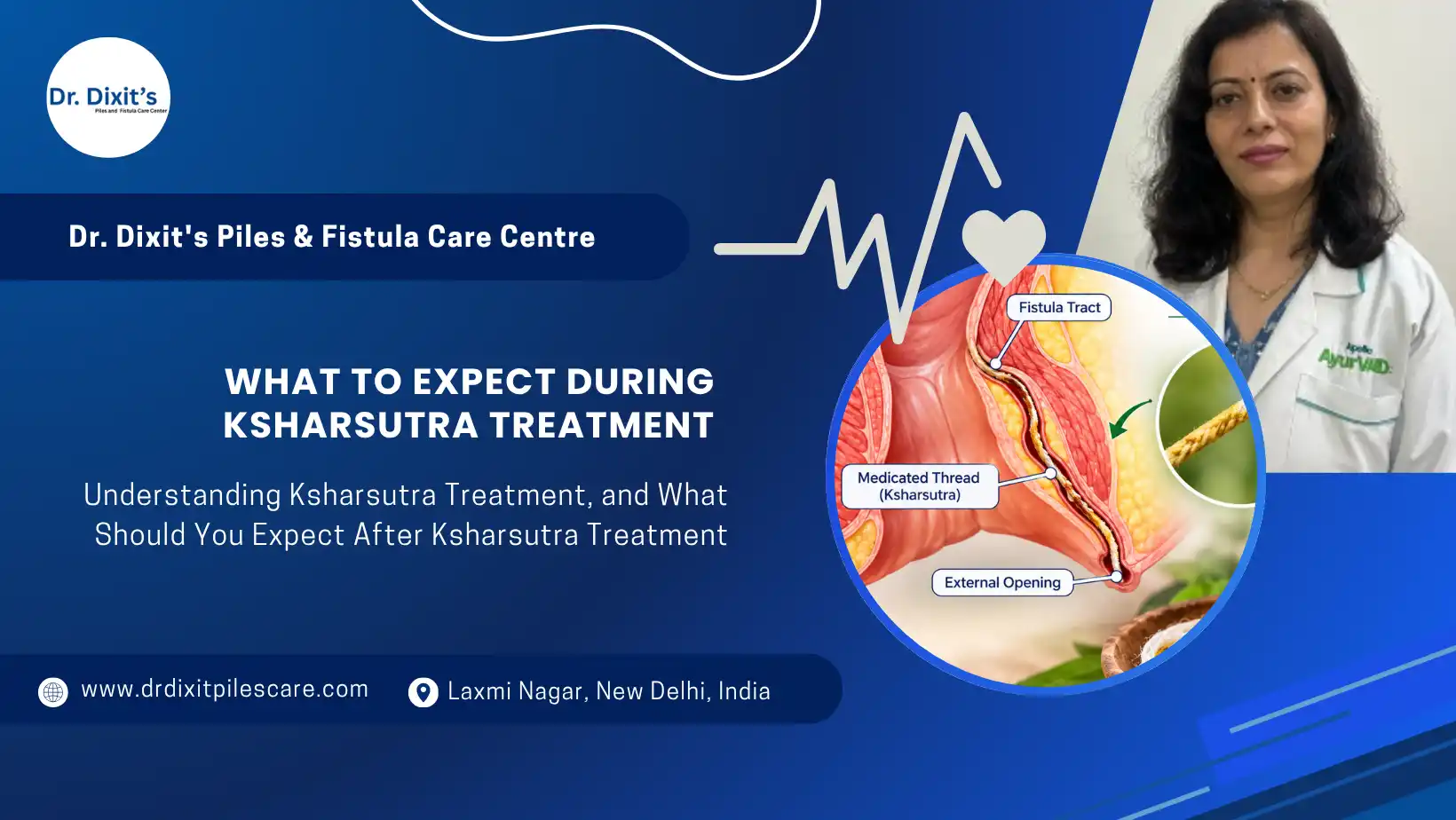 What to Expect During Ksharsutra Treatment